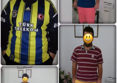 Danışan Mikail Önce Sonra